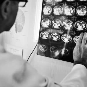 neurofeedback for adhd